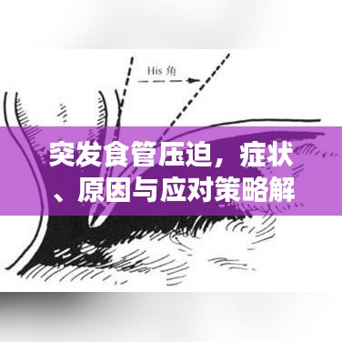 突发食管压迫，症状、原因与应对策略解析